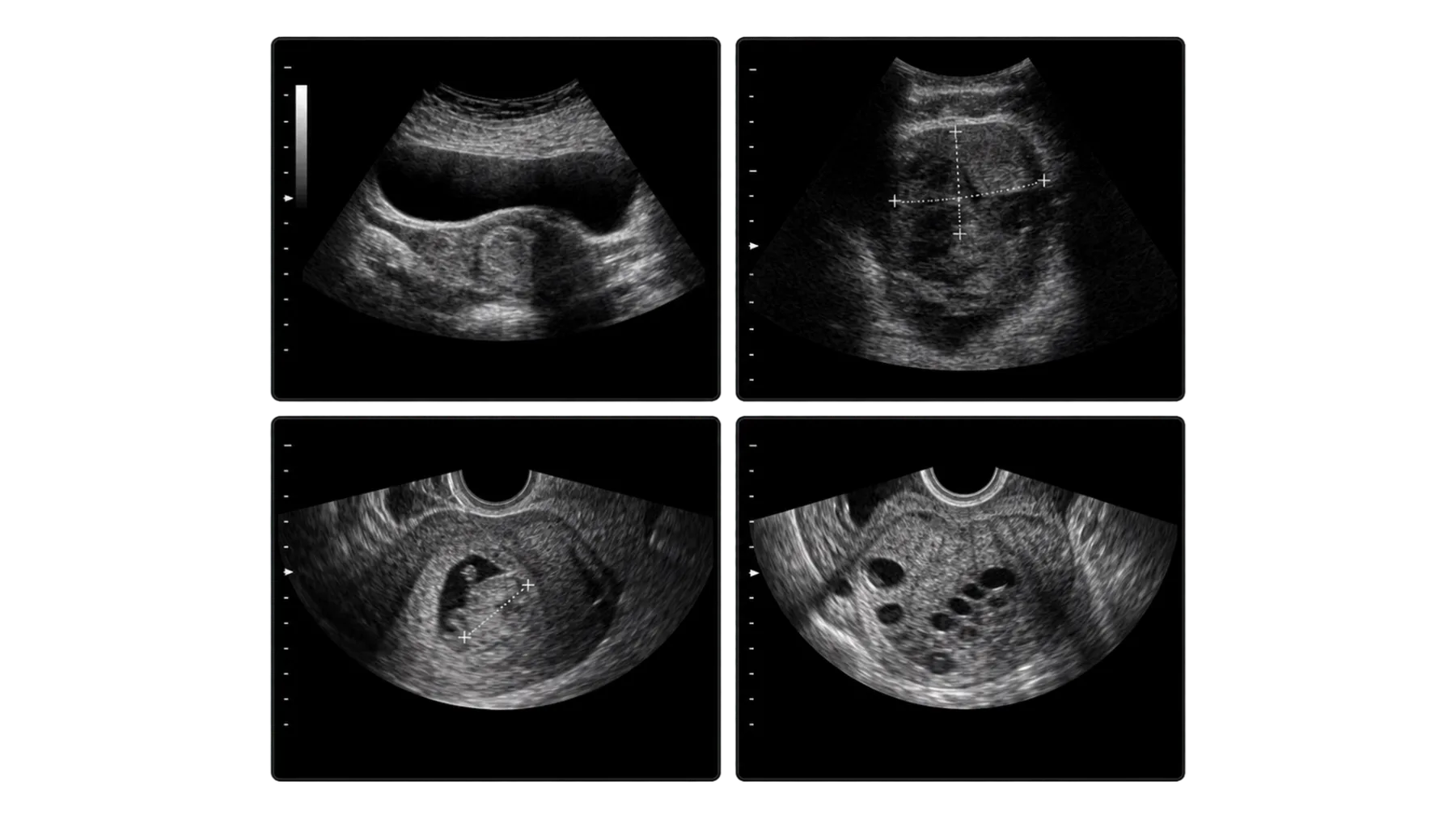 Ultrasound / illustrative imaging examples